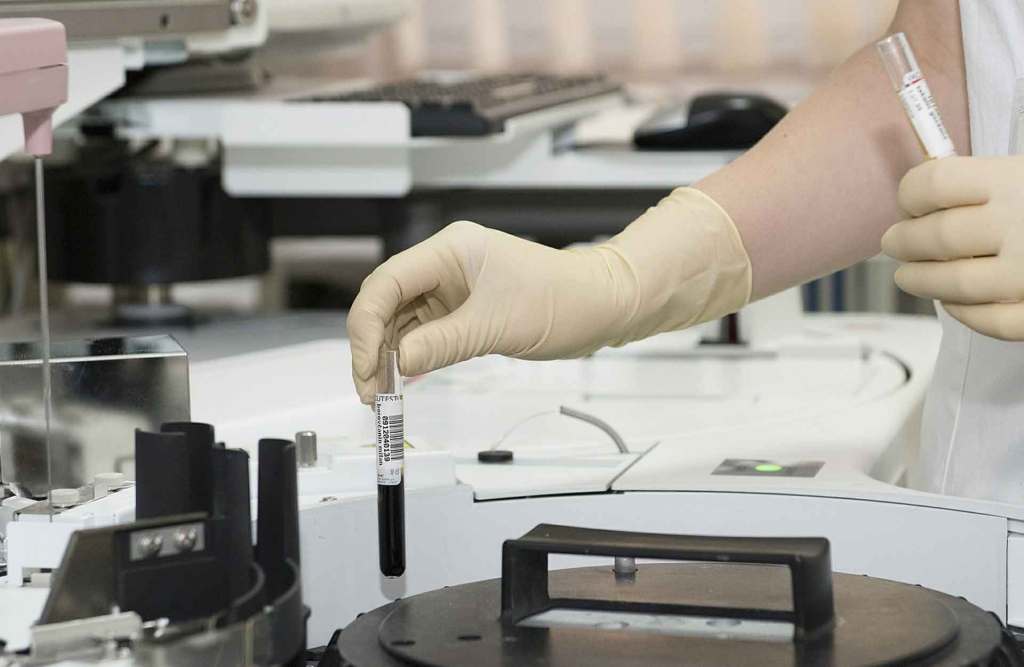 Avoid Wheat-Based Ethanol: Wheat is a common allergen, and even trace amounts of wheat proteins or gluten in the ethanol can pose significant risks to individuals with wheat allergies or celiac disease.